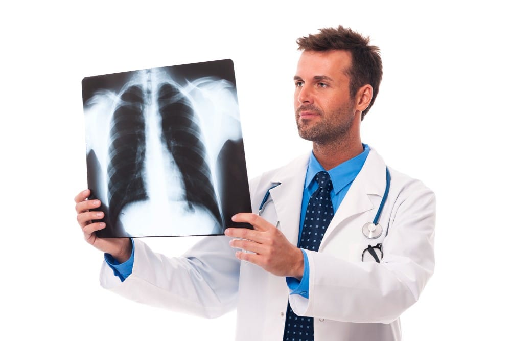 O que e Cirrose Pulmonar e Tratamento 1